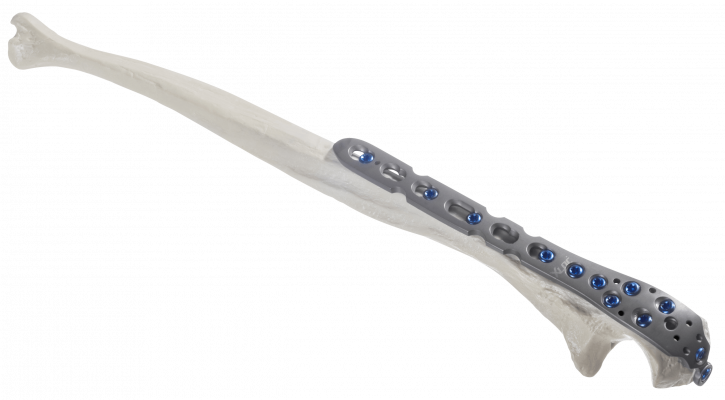 Olecranon_AF-Medical_161-1