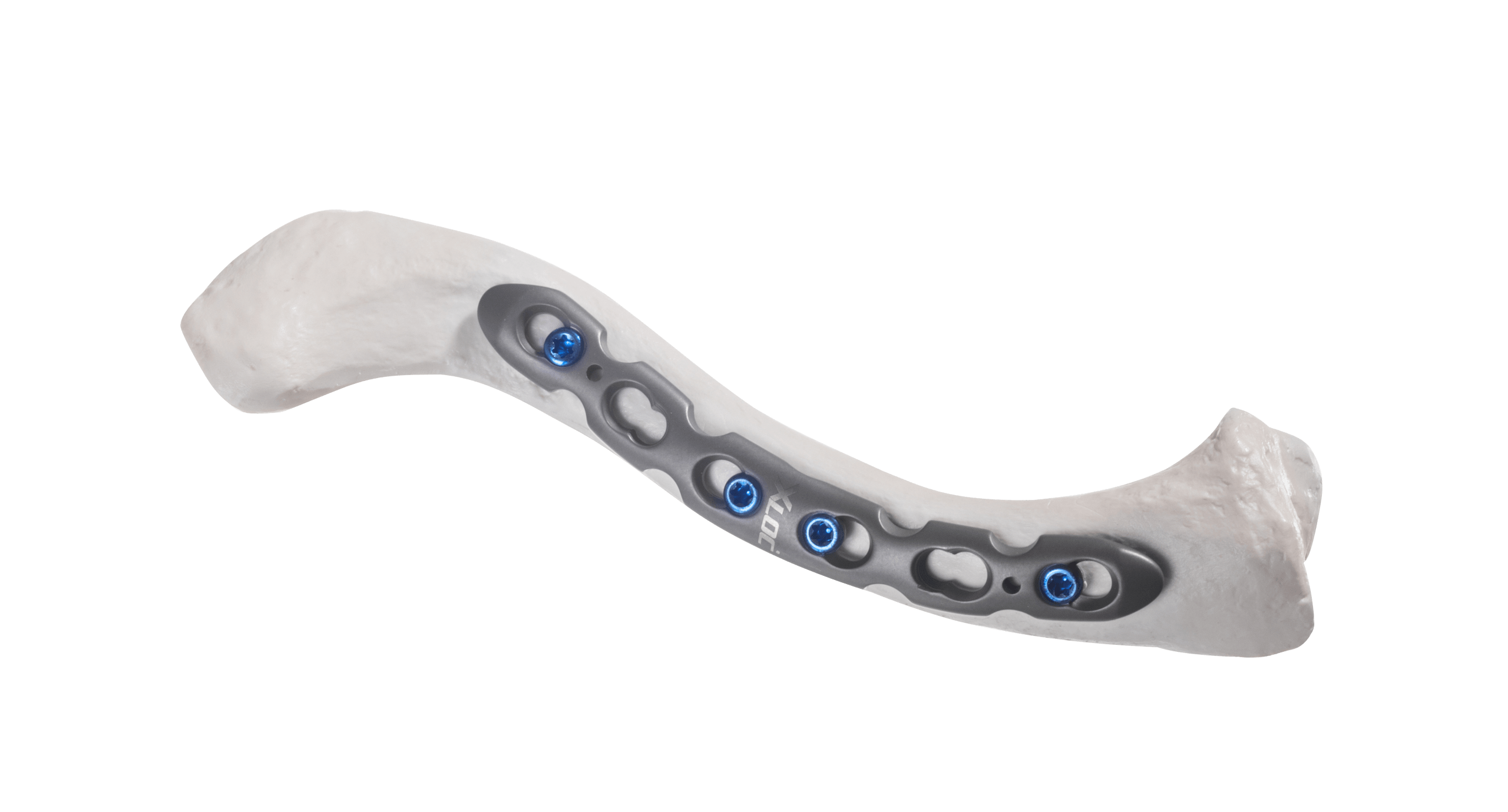 Clavicle-superior_AF-Medical_162