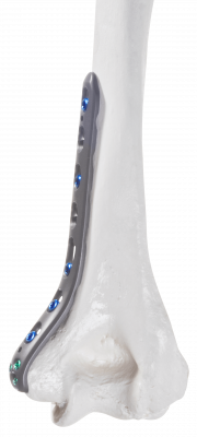 Humerus-distal-medial_AF-Medical_158