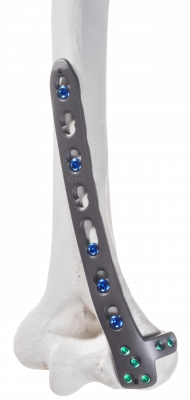 Humerus-distal-dorsolateral-support